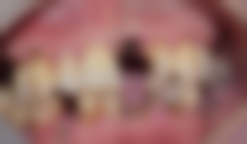 黑龙江哈尔滨微笑口腔特色诊疗技术