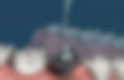 上海瑞信口腔来院指引