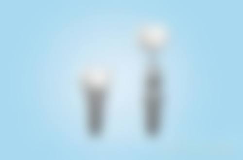 济南历城邦齿洁口腔诊所特色诊疗技术