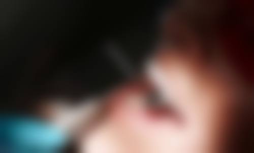 张康豪的临床实战与个性化诊疗