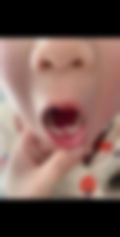 杭州红莹口腔收费价格参考