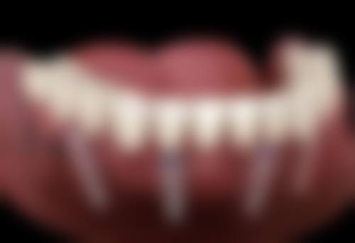 蒋涛的诊疗价格与就诊指引