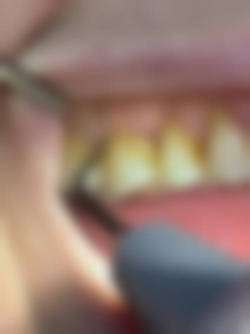 福建漳州南兴口腔的特色诊疗技术