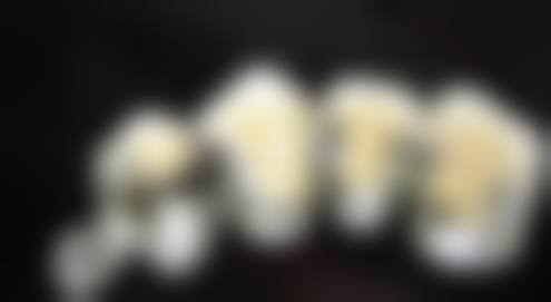 贵州省六盘水盘州市晶皓口腔收费价格标准