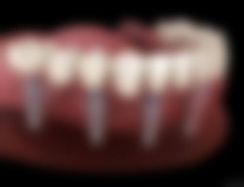 三亚吉阳鼎点口腔门诊部来院指引与预约方式