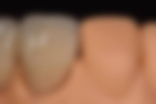 三亚吉阳鼎点口腔门诊部患者真实口碑评价