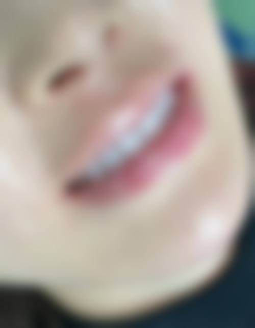 江苏连云港灌南博强口腔正规资质