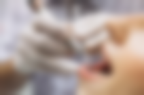 沙坪坝刘自长口腔就诊体验与补贴