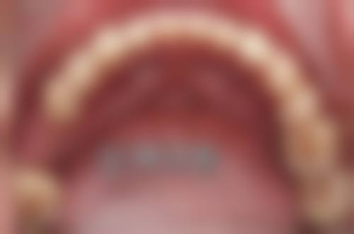 合肥瑶海品圆口腔门诊部特色诊疗技术