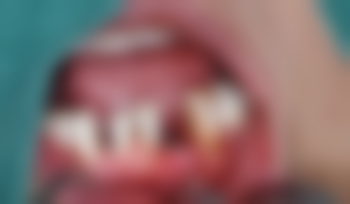 沙坪坝刘自长口腔患者真实口碑