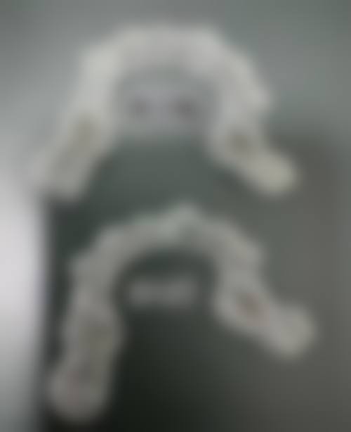 南宁天使口腔医院患者真实评价