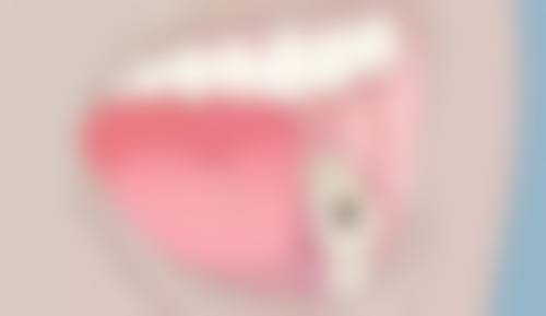 益阳乐亿口腔诊所患者真实评价