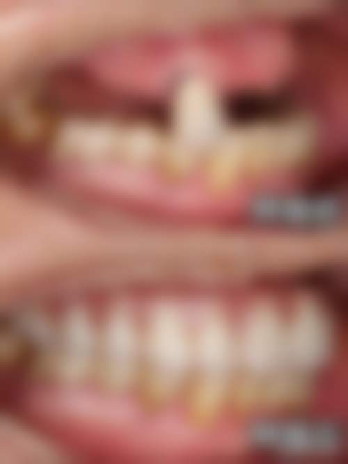 西安金贝口腔门诊部（未央店）特色诊疗技术