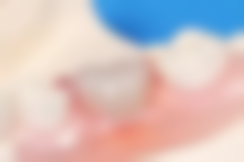 靖江瑞泰口腔门诊部设备与技术优势