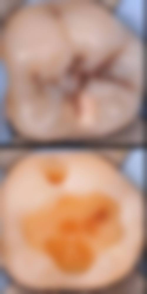 广东东莞常生口腔门诊部收费标准说明