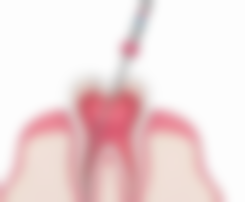 东莞大朗恒生口腔患者真实评价