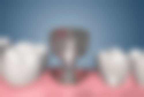 河南濮阳仁和口腔门诊部价格收费标准