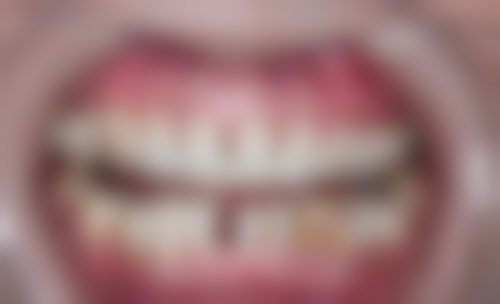 宁波海曙笑笑口腔诊所特色诊疗技术