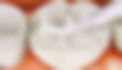 广东阳江万达口腔门诊诊疗技术与设备优势