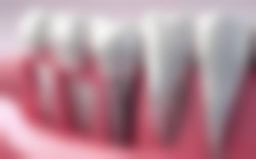 河北张家口张北一佳口腔患者真实口碑