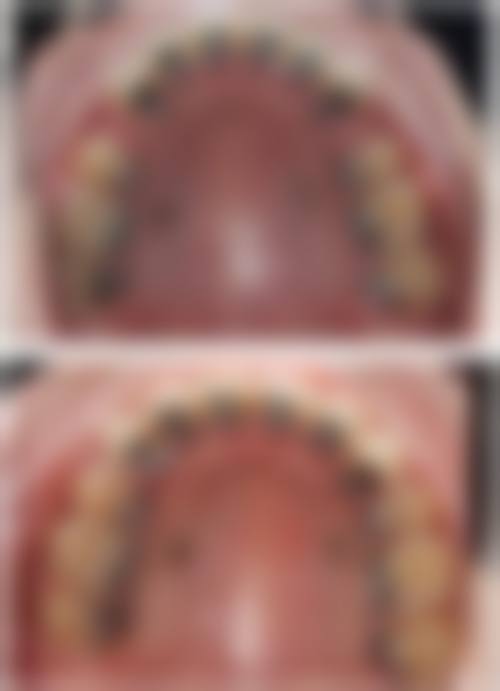 湖北孝感南卧口腔医院收费价格参考