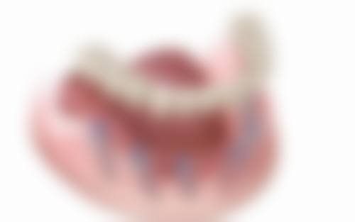 花都暨博口腔医院·种植正畸中 心特色诊疗项目