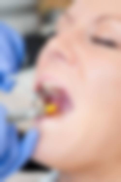 达州康美口腔患者真实评价