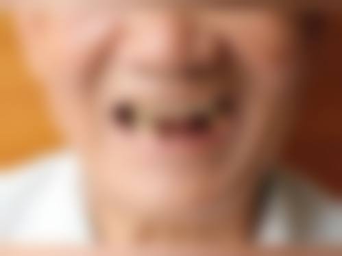 北京李艳玲口腔诊所患者真实评价