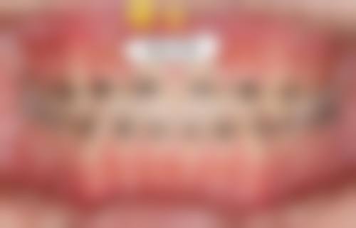 大埔嘉诚口腔门诊部价格收费标准