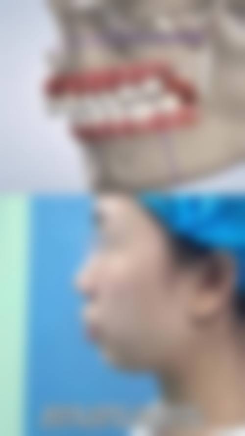 三门峡湖滨小白熊口腔诊所特色诊疗技术