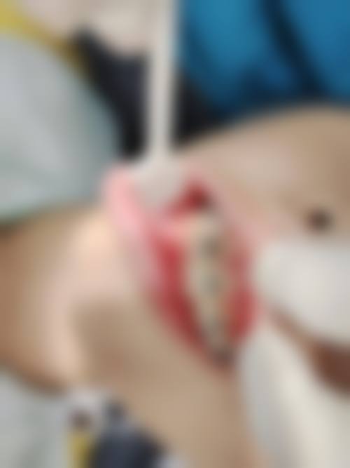 广东东莞大岭山状元口腔门诊部特色诊疗技术