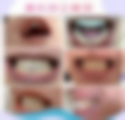 安徽蚌埠德瓦口腔诊所特色诊疗技术