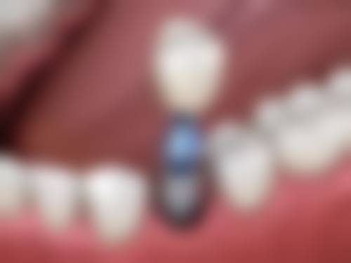 中山升艺口腔医院诊疗项目与收费标准