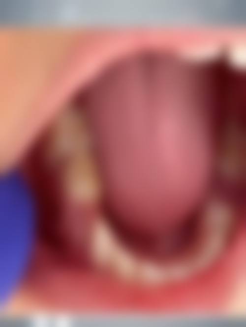 为什么要选择江门蓬江贝壳口腔诊所?