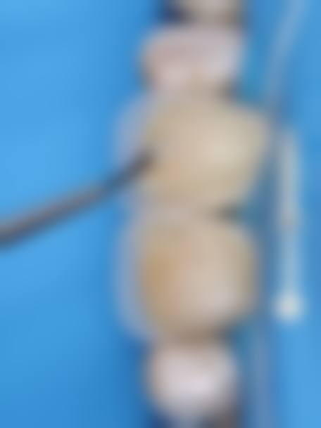 汕头佳乐口腔门诊部特色项目及技术优势