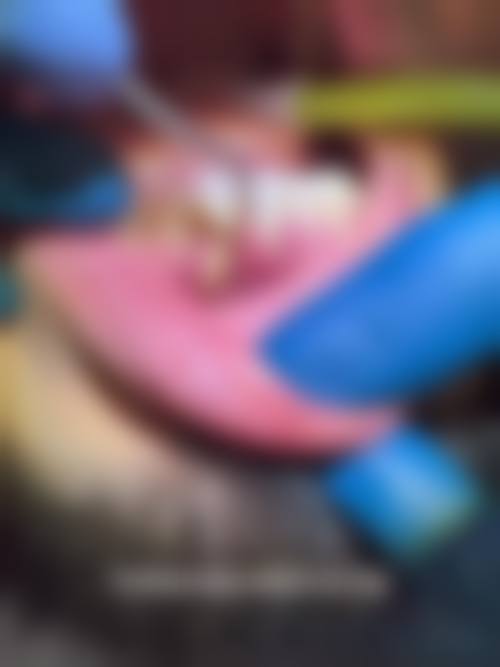 湖南常德圣康口腔特色项目及技术优势