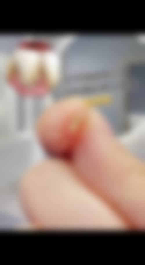 为什么要选择常熟雅博口腔?
