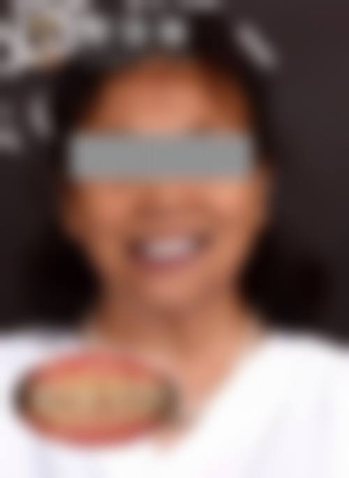 谢莲丽的临床实战与真实实例