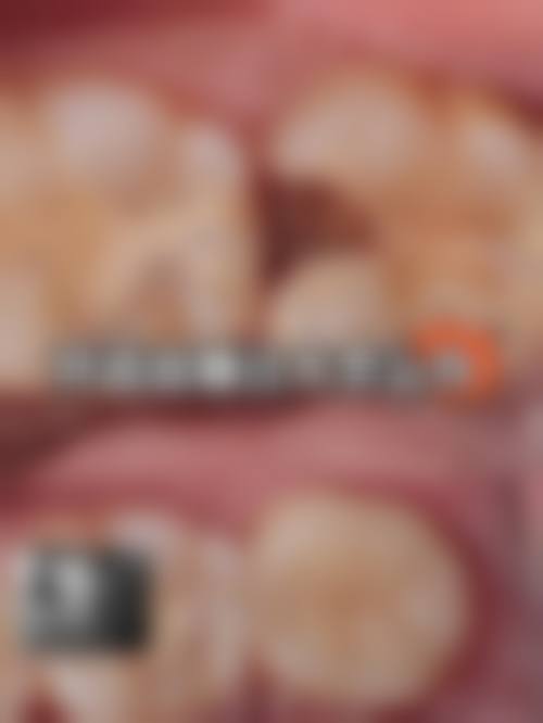 为什么要选择成都金牛禾睦鲁仕口腔门诊部?