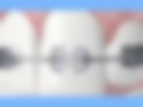 为什么要选择南昌雅博口腔门诊部?