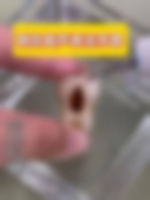 北京嘉悦口腔诊所是正规的吗/怎么样/靠谱吗