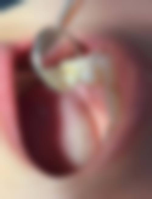 玉溪原艳口腔诊所是正规的吗/怎么样/靠谱吗