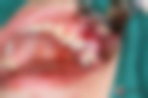 3. 宋晓蕾的临床实战与真实实例