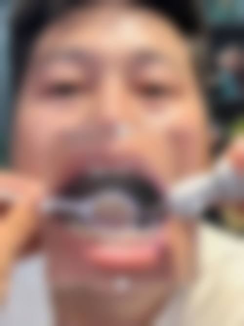 广东东莞长安瑞芽口腔怎么样预约挂号