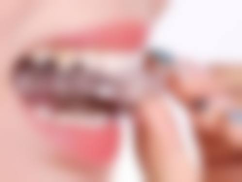 孝感明珠口腔诊所是正规的吗