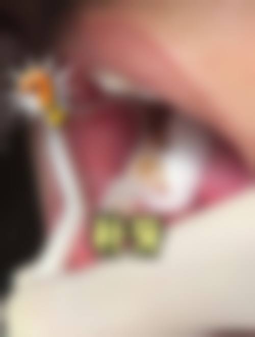广东东莞长安瑞芽口腔交通路线攻略