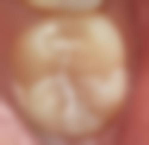 山东临沂兰山张兴红口腔口碑怎么样